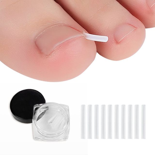 내향성 발톱 관리 밴드 와이어 팁 10p